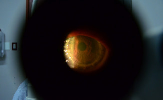 Em ação na Praça dos Girassóis, Governo reforça campanha para doação de córneas no Tocantins