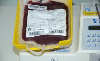 Hemocentro de Palmas está com baixo estoque de bolsas de sangue e necessita de doações urgentes