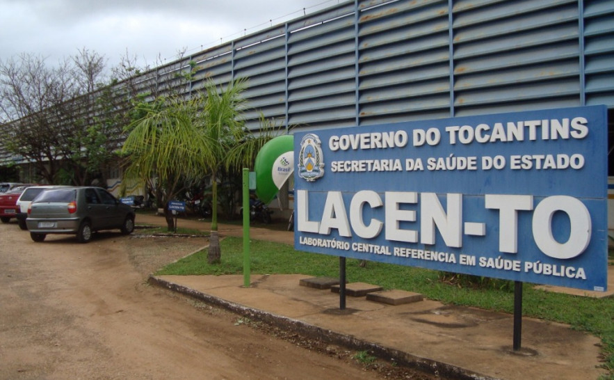 Lacen