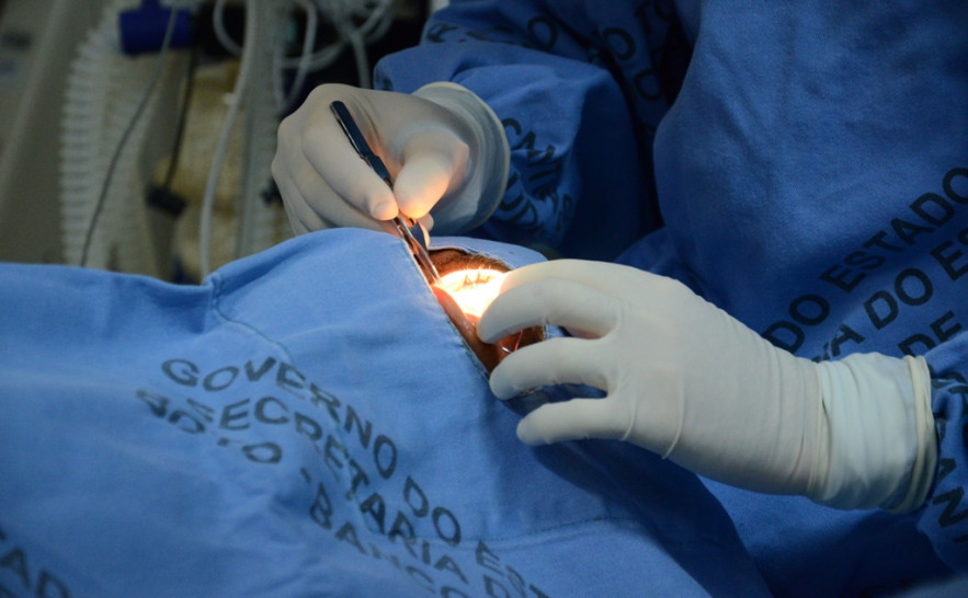 Já foram realizados 53 transplantes no Tocantins 