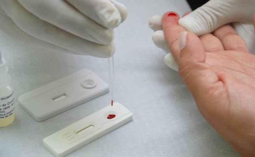 Teste Rápido da Aids- Ascom-Sesau.jpg