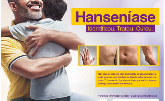 Saúde será representada em Seminário que abordará desafios para Brasil livre de Hanseníase 