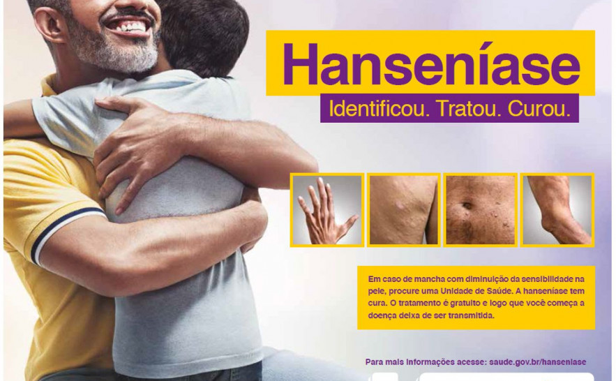 Hanseníase (2).jpg