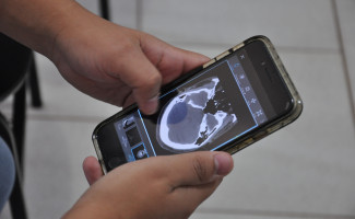 HGP conta com aplicativo que reduz o tempo de assistência ao paciente com AVC