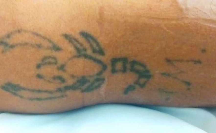 Tatuagem do paciente não identificado na UTI HGP