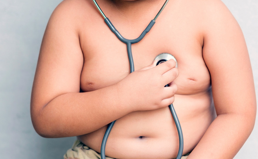 obesidade infantil 