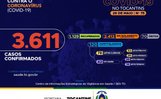 Acompanhe o 75º boletim epidemiológico da Covid-19 no Tocantins ️ 29/05