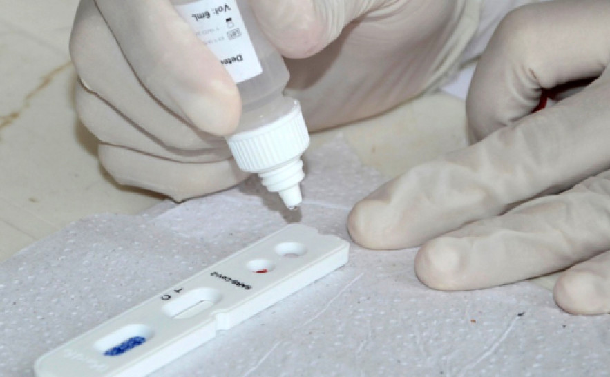 Secretaria de Estado da Saúde emite nota técnica sobre testes rápidos da Covid-19 em farmácias