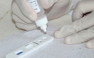 Governo do Tocantins apresenta raio-x da pandemia da Covid-19 no Estado