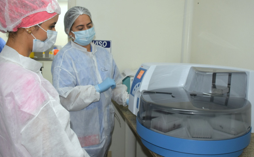 LACEN/TO divulgará resultados de testes de Covid-19 em até 48 horas